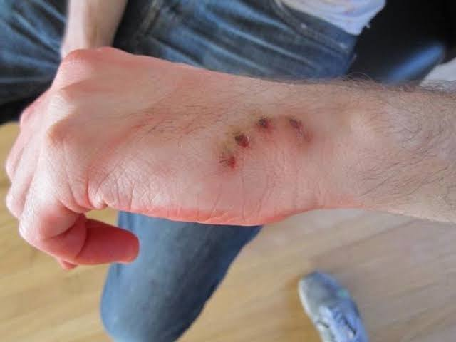 Як виглядає укус шаленого собаки та як проявляється сказ у тварин
